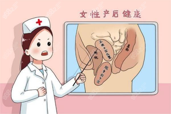 陰道松弛對(duì)女性危害大