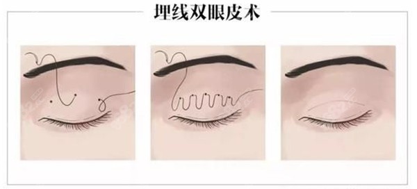 国内做眼修复医生排名前十的大佬