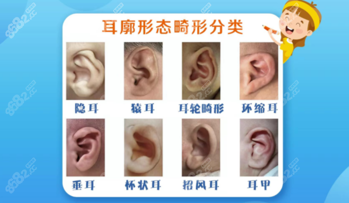 重庆松山医院耳朵手术费用多少钱