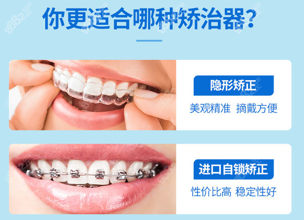 杭州微线加口腔隐形牙套比金属矫正价格贵4000