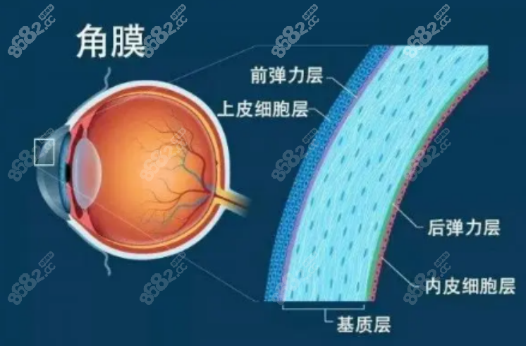 近视眼手术