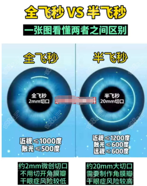 杭州太学眼科董媛医生飞秒激光技术怎么样