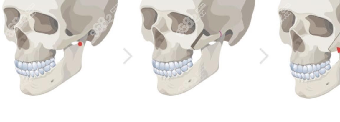 <!--<i data=20240705-sp></i>-->擅长轮廓整形
