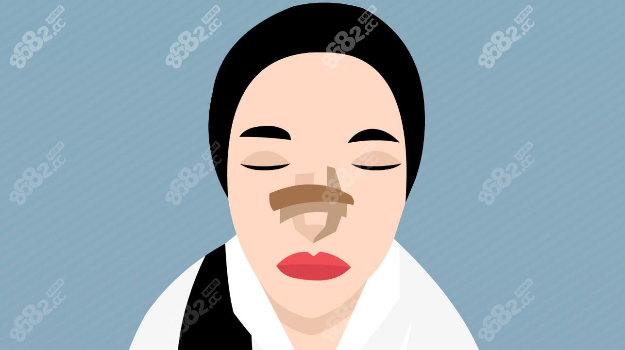 <!--<i data=20240705-sp></i>-->鼻子事例 <!--<i data=20240705-sp></i>-->鼻子事例