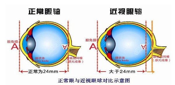 大连近视手术费用表8682.cc