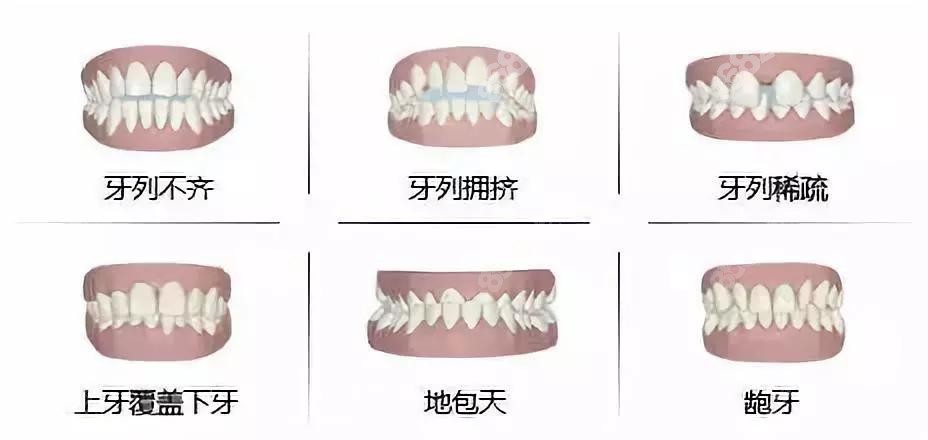 昆明松鼠口腔韩峄医生矫正牙齿怎么样