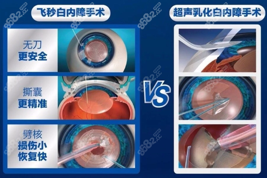 <!--<i data=20240705-sp></i>-->眼科白内障手术价格