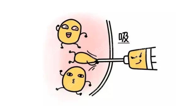 北京腰腹吸脂医院哪家做的好