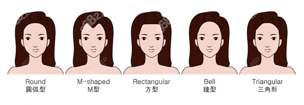 各类脱发都可以改善