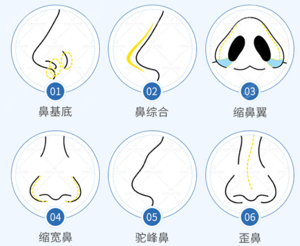 李保锴医生隆鼻审美风格