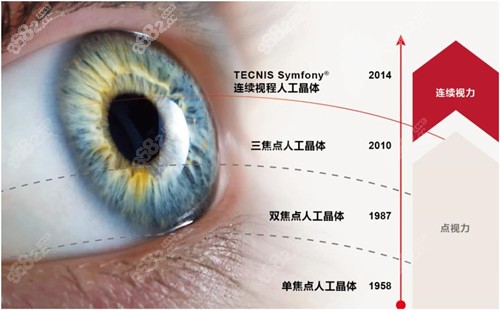 蔡司全视觉三焦点人工晶体变化