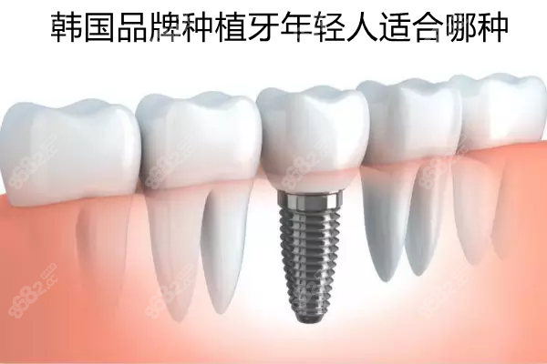 韩国品牌种植牙适合年轻人的有哪些