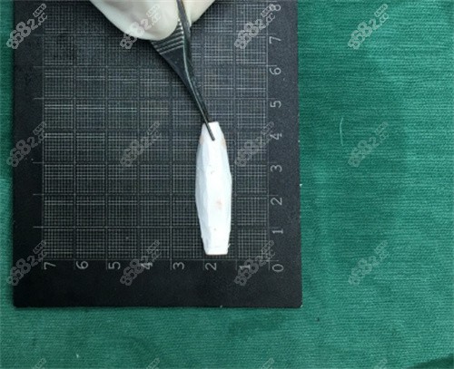 深圳宝丽假体雕刻