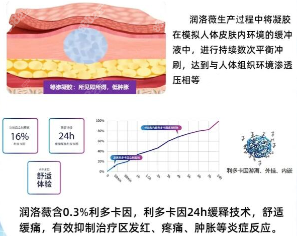 注射润洛薇玻尿酸痛感低