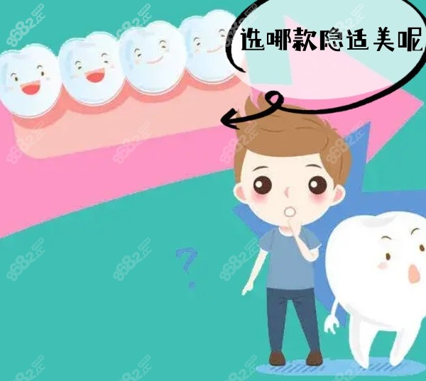 隐适美有几个版本6个