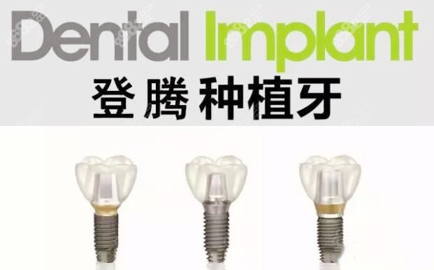 年轻人做韩国奥齿泰、登腾、美格真种植牙优势