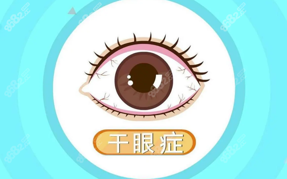 干眼症可以做全飞秒激光手术吗？