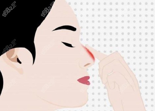 深圳美莱梁晓健做鼻子怎么样