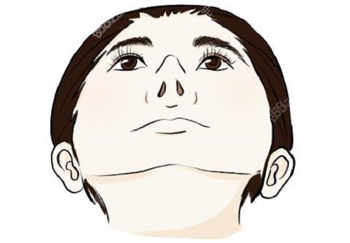 深圳美莱梁晓健做鼻子怎么样