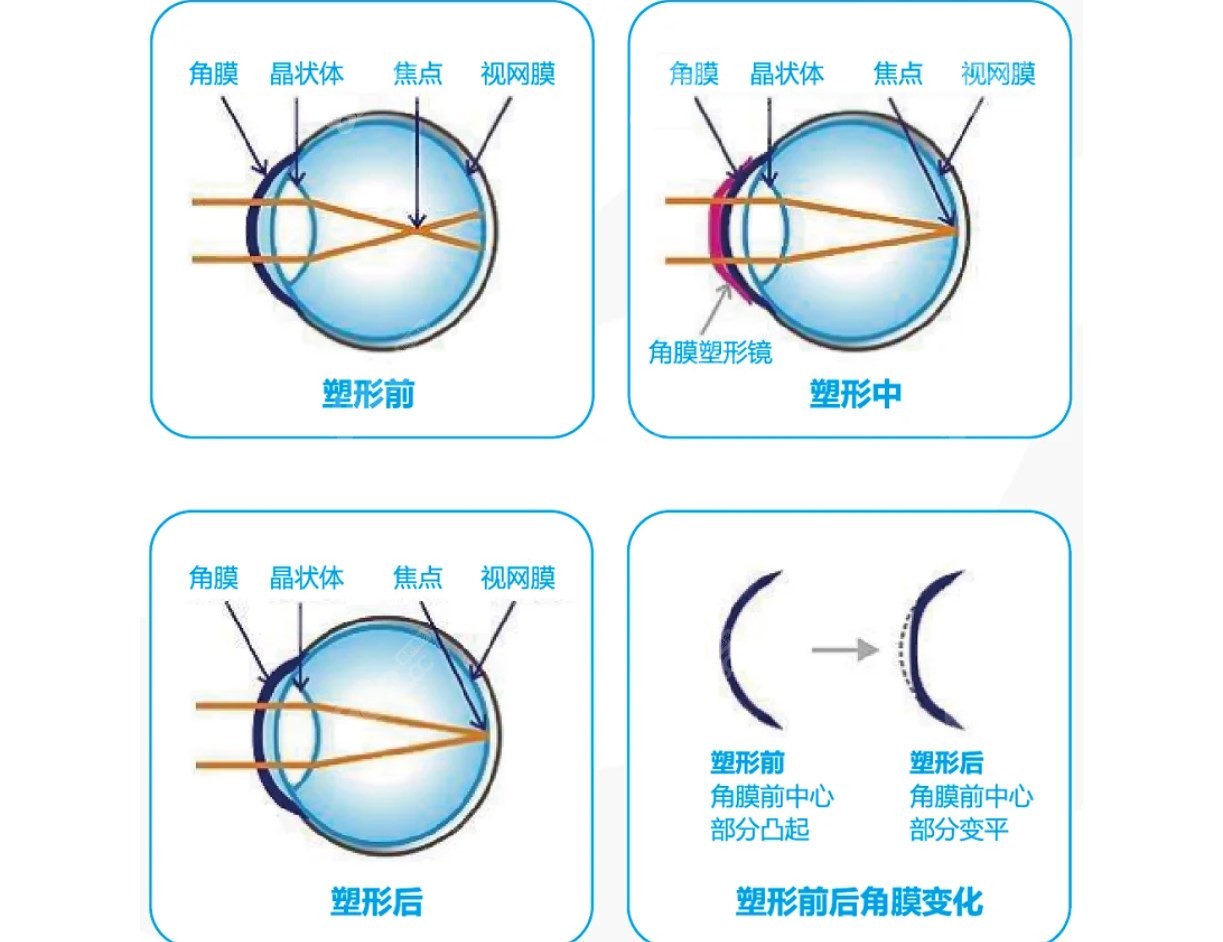 ok镜原理