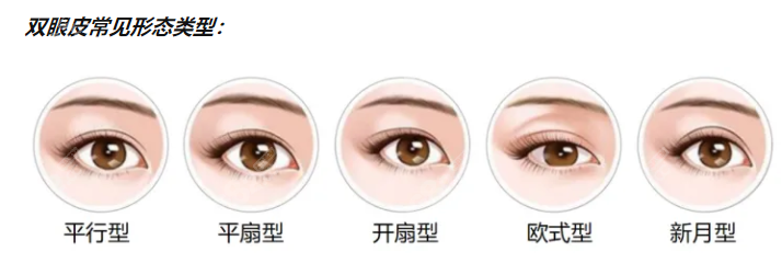 周敏茹双眼皮做的咋样