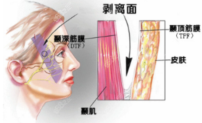 <!--<i data=20240705-sp></i>-->医疗美容门诊部面部提升