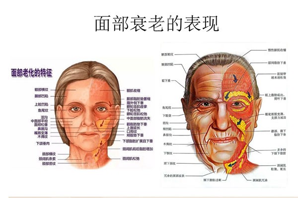 北京加减美v美减龄技术6大适应人群