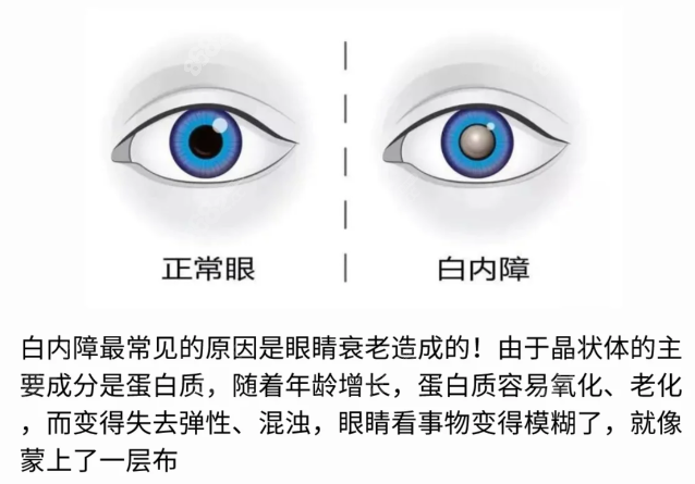 <!--<i data=20240705-sp></i>-->眼科医院艾碧君简介