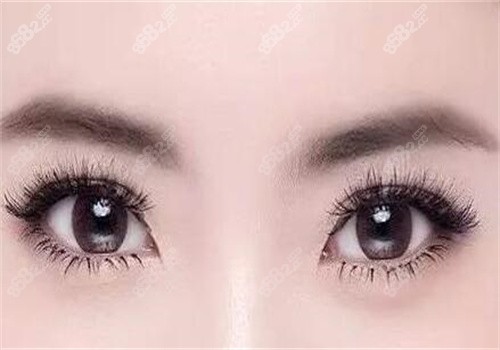 南京友谊高伟成做双眼皮时审美素养好