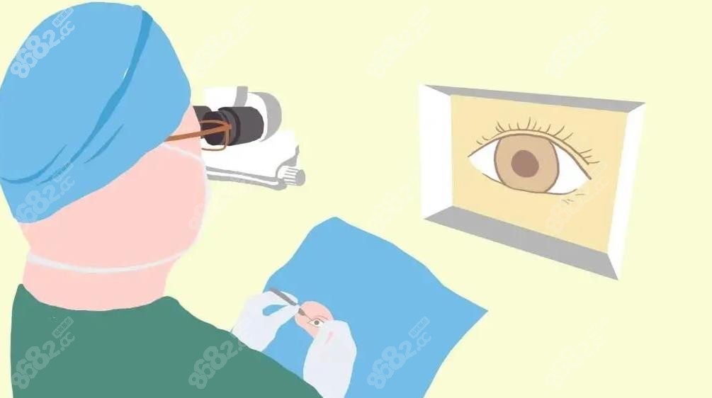 厦门眼科准分子近视眼手术价格