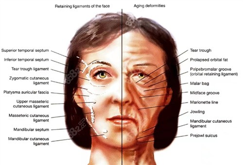 面部韧带示意图