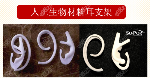人工生物材料耳支架
