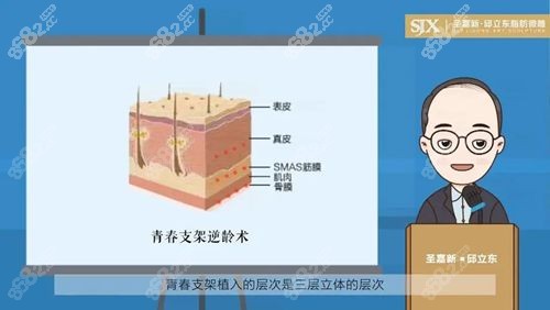 青春支架术和拉皮手术的区别有5点