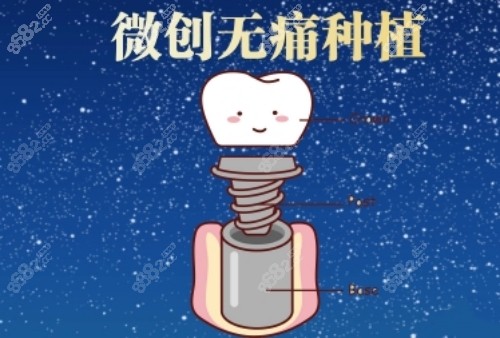 口腔连锁种植牙技术扎实