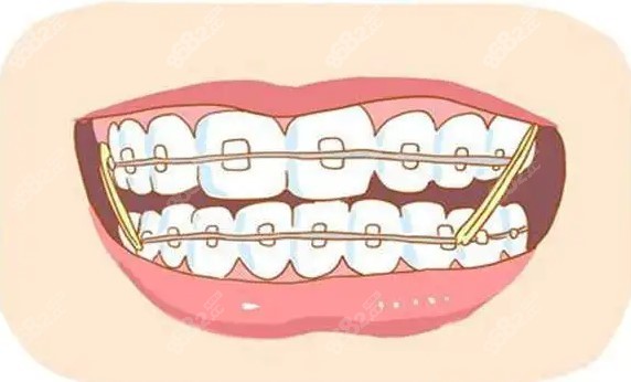 合肥贝尔口腔牙齿矫正怎么样