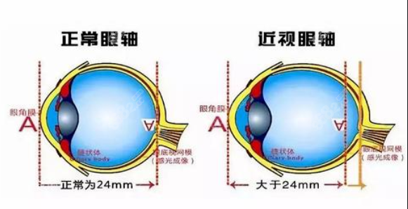 德阳近视眼手术价格表显示收费是：9000-35000元左右