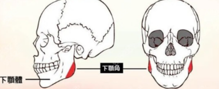 下颌角修复