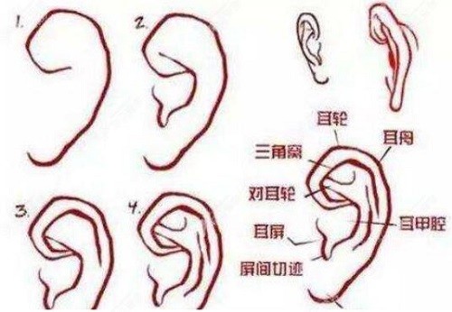 生物支架耳再造的缺点