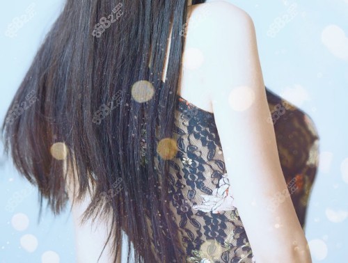  韩国普罗菲耳医院郑在皓隆胸修复实例 