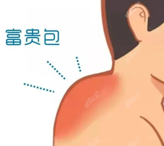富贵包