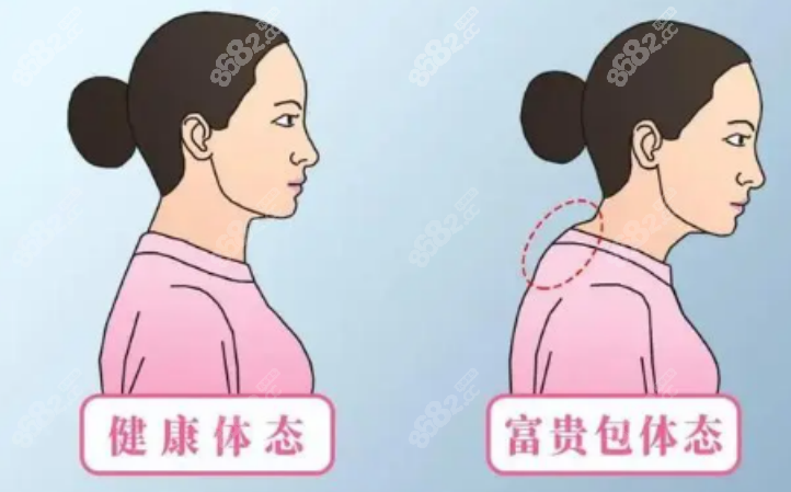 富贵包