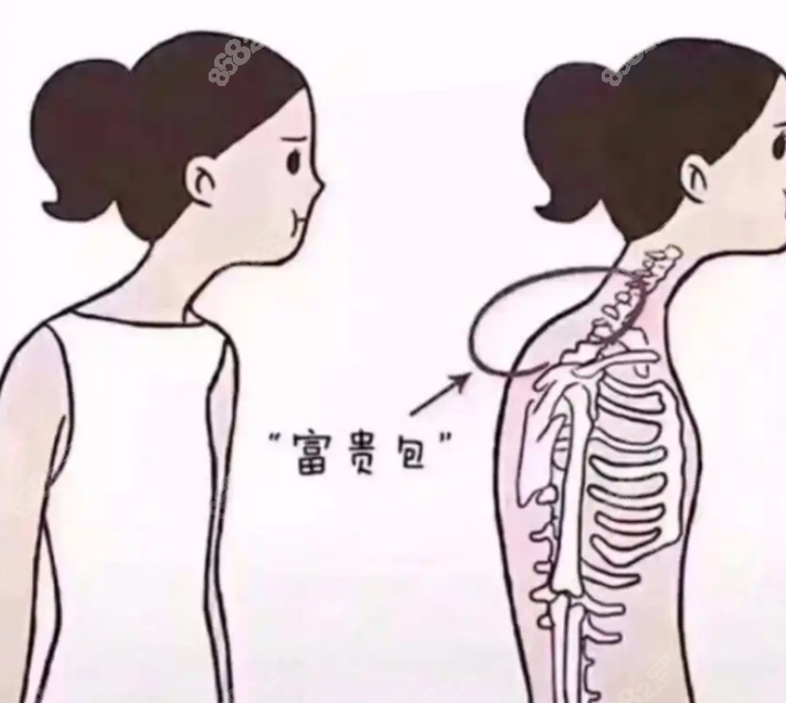 富贵包