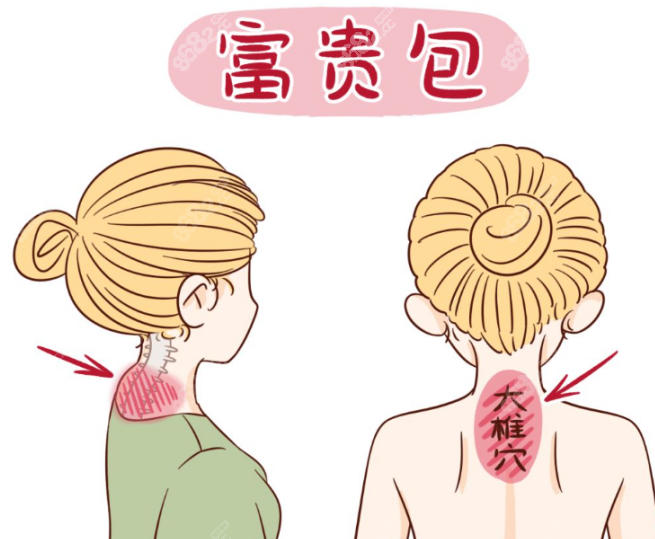 富贵包