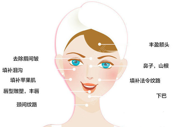 1ml的爱拉丝提玻尿酸能打的部位比较多