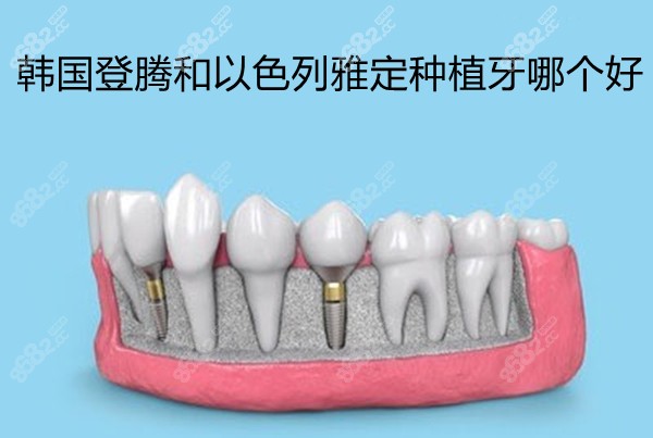 韩国登腾和以色列雅定种植牙哪个好