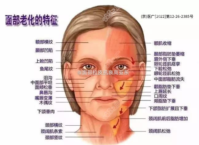 高亚东的价格太贵了