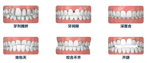 北京诺泰口腔牙齿矫正多少钱？