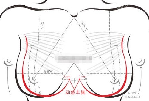 许扬滨丰胸怎么样