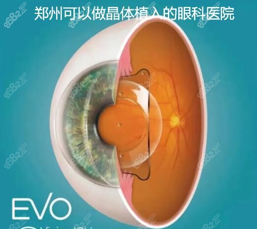 郑州可以做晶体植入的眼科:尖峰眼科近视和白内障植入可做