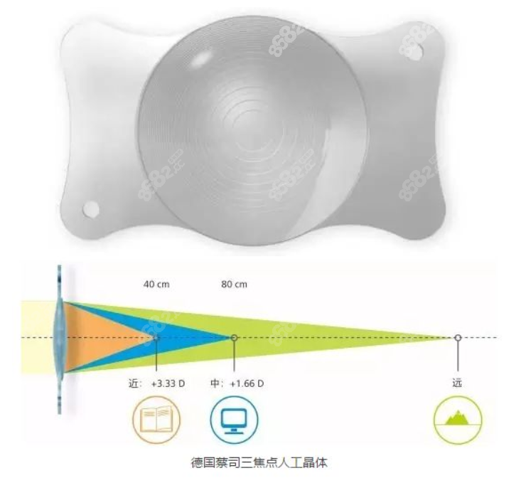 蔡司三焦点人工晶体